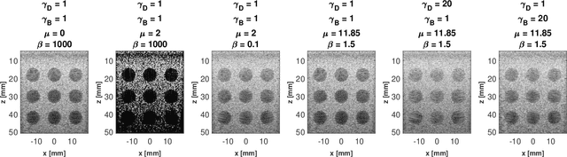 Figure 4 for A Unifying Approach to Ultrasound Beamforming and Deconvolution Using ADMM