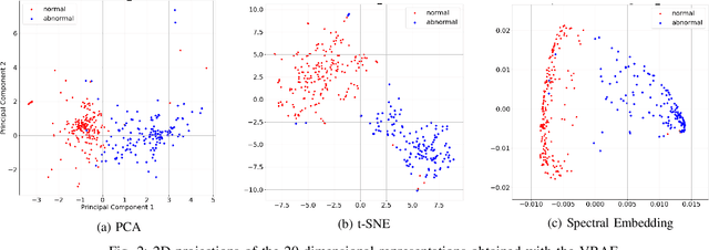 Figure 2 for Anomaly Detection of Wind Turbine Time Series using Variational Recurrent Autoencoders