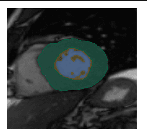 Figure 1 for Deep learning approach to left ventricular non-compaction measurement