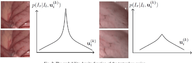 Figure 2 for Bayesian dense inverse searching algorithm for real-time stereo matching in minimally invasive surgery