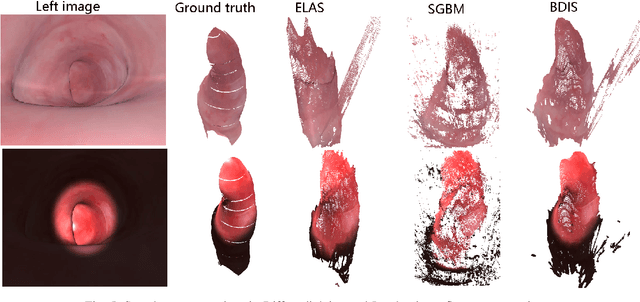 Figure 4 for Bayesian dense inverse searching algorithm for real-time stereo matching in minimally invasive surgery