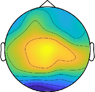 Figure 1 for Convolutional Neural Networks for Automatic Detection of Artifacts from Independent Components Represented in Scalp Topographies of EEG Signals