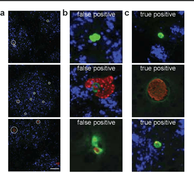 Figure 1 for Image segmentation of liver stage malaria infection with spatial uncertainty sampling