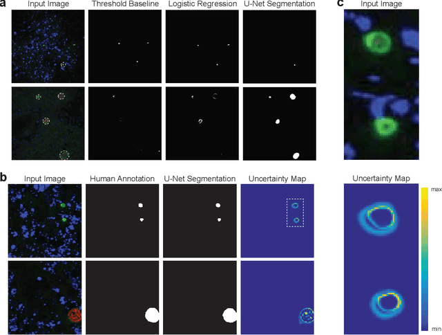 Figure 3 for Image segmentation of liver stage malaria infection with spatial uncertainty sampling