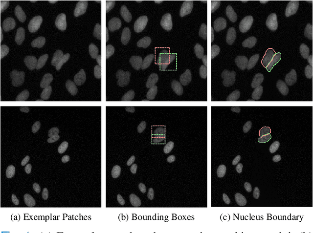 Figure 1 for CPP-Net: Context-aware Polygon Proposal Network for Nucleus Segmentation