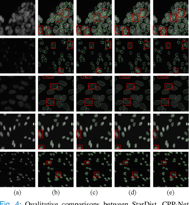 Figure 4 for CPP-Net: Context-aware Polygon Proposal Network for Nucleus Segmentation
