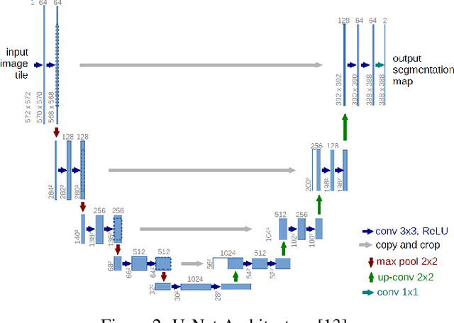 Figure 3 for The 2ST-UNet for Pneumothorax Segmentation in Chest X-Rays using ResNet34 as a Backbone for U-Net
