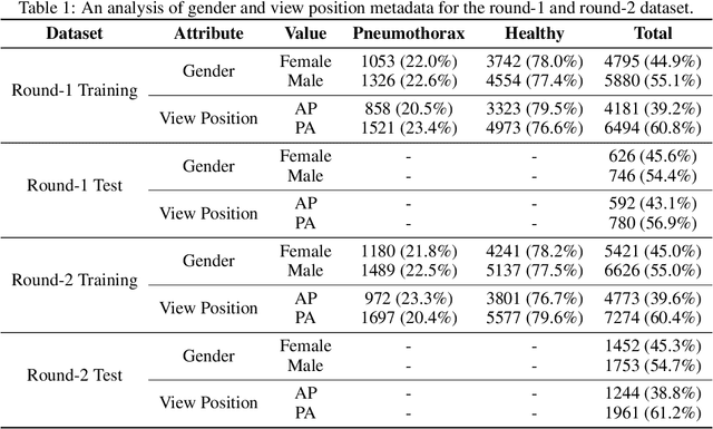 Figure 2 for The 2ST-UNet for Pneumothorax Segmentation in Chest X-Rays using ResNet34 as a Backbone for U-Net