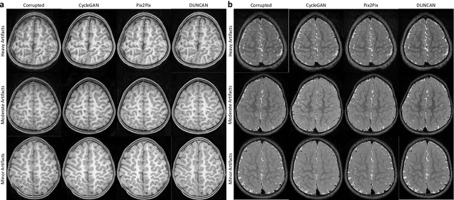 Figure 2 for Learning MRI Artifact Removal With Unpaired Data