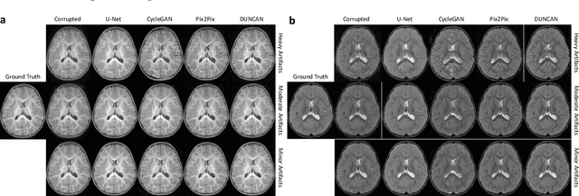 Figure 3 for Learning MRI Artifact Removal With Unpaired Data