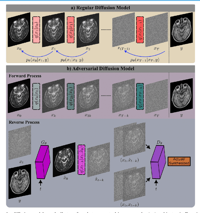 Figure 1 for Unsupervised Medical Image Translation with Adversarial Diffusion Models