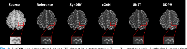 Figure 4 for Unsupervised Medical Image Translation with Adversarial Diffusion Models