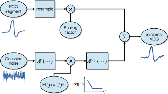 Figure 2 for AI Aided Noise Processing of Spintronic Based IoT Sensor for Magnetocardiography Application