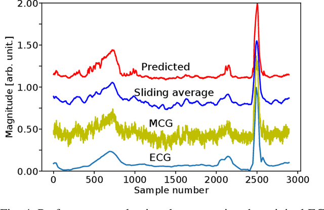 Figure 4 for AI Aided Noise Processing of Spintronic Based IoT Sensor for Magnetocardiography Application