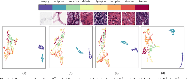 Figure 1 for Supervision and Source Domain Impact on Representation Learning: A Histopathology Case Study