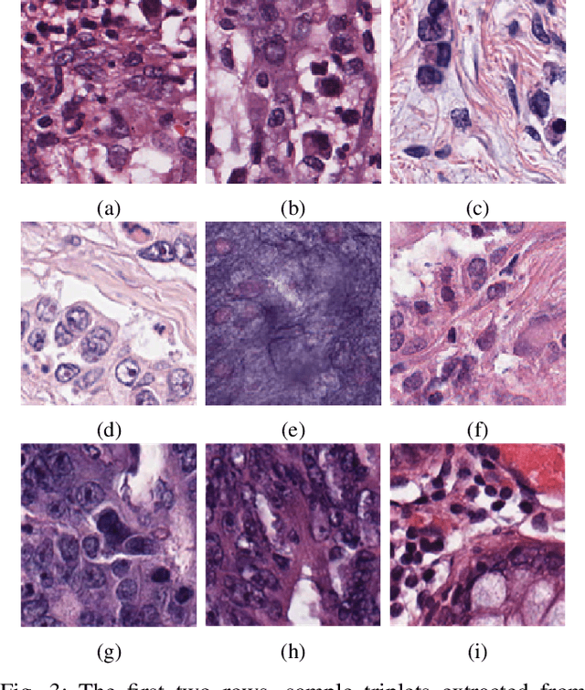 Figure 3 for Supervision and Source Domain Impact on Representation Learning: A Histopathology Case Study