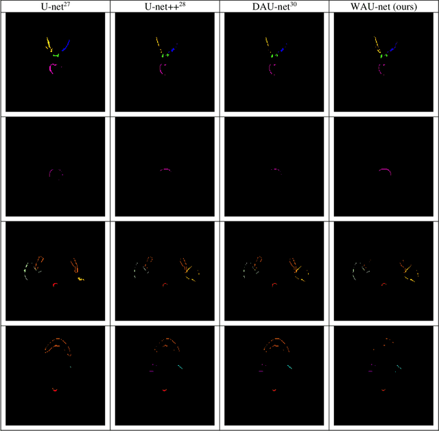 Figure 4 for Weaving Attention U-net: A Novel Hybrid CNN and Attention-based Method for Organs-at-risk Segmentation in Head and Neck CT Images