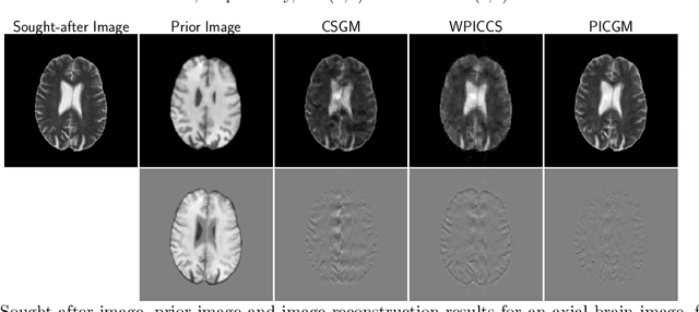 Figure 3 for Prior image-based medical image reconstruction using a style-based generative adversarial network