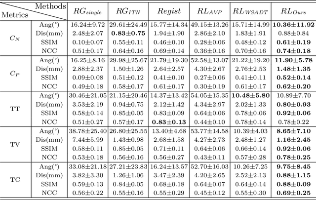Figure 2 for Agent with Tangent-based Formulation and Anatomical Perception for Standard Plane Localization in 3D Ultrasound