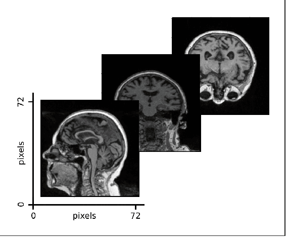Figure 2 for Multimodal Attention-based Deep Learning for Alzheimer's Disease Diagnosis