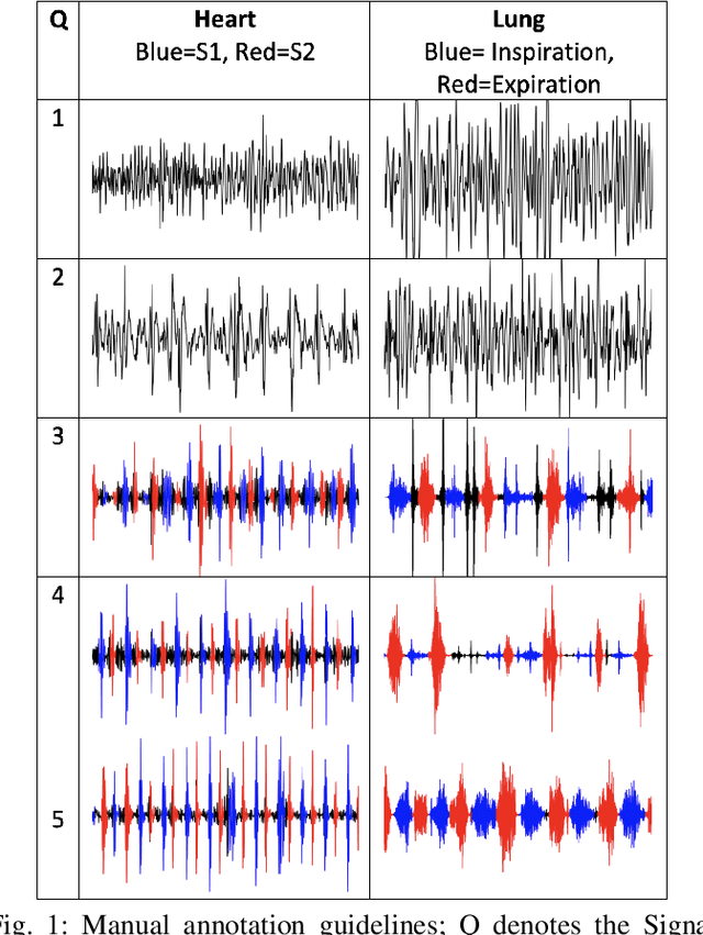 Figure 1 for Real-Time Multi-Level Neonatal Heart and Lung Sound Quality Assessment for Telehealth Applications