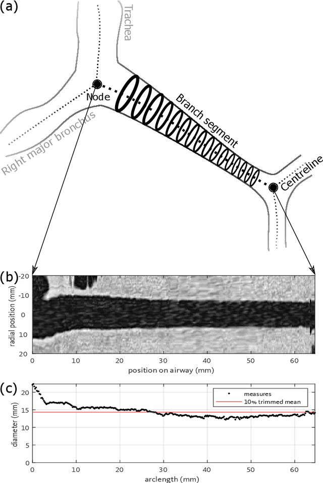 Figure 1 for Evaluation of automated airway morphological quantification for assessing fibrosing lung disease