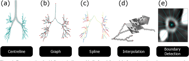 Figure 3 for Evaluation of automated airway morphological quantification for assessing fibrosing lung disease