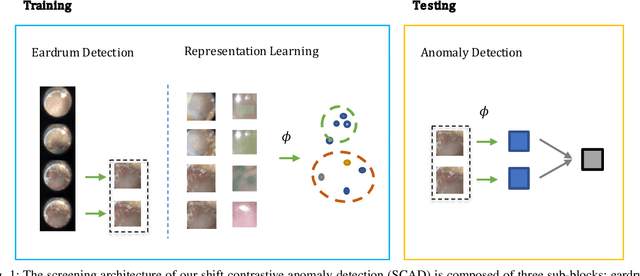 Figure 1 for Pediatric Otoscopy Video Screening with Shift Contrastive Anomaly Detection