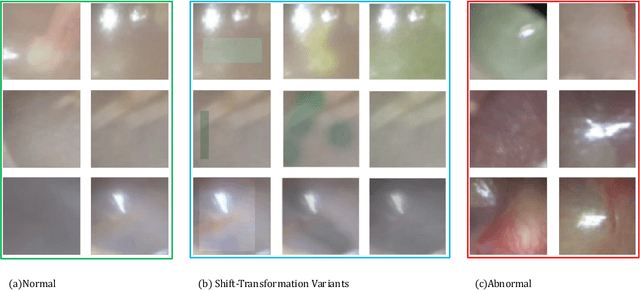 Figure 3 for Pediatric Otoscopy Video Screening with Shift Contrastive Anomaly Detection