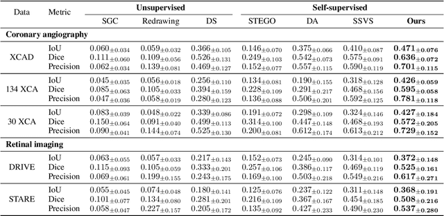 Figure 2 for Diffusion Adversarial Representation Learning for Self-supervised Vessel Segmentation