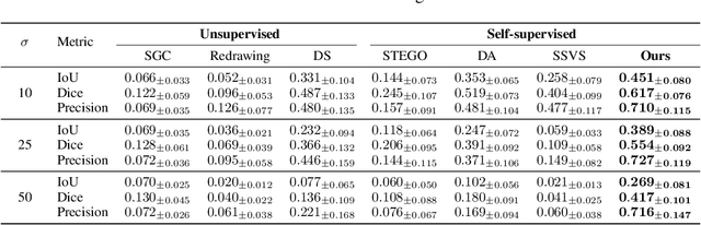 Figure 4 for Diffusion Adversarial Representation Learning for Self-supervised Vessel Segmentation