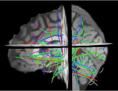 Figure 1 for The Approximation of the Dissimilarity Projection