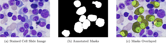 Figure 1 for Multiple Myeloma Cancer Cell Instance Segmentation