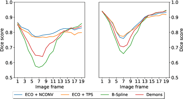 Figure 4 for Registration by tracking for sequential 2D MRI
