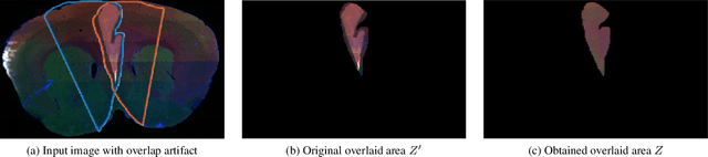 Figure 3 for Separating Overlapping Tissue Layers from Microscopy Images