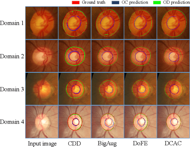 Figure 4 for Contrastive Domain Disentanglement for Generalizable Medical Image Segmentation