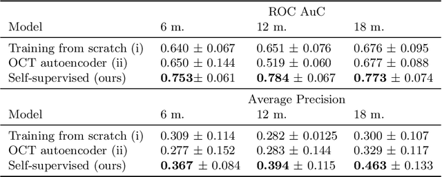 Figure 4 for Modeling Disease Progression In Retinal OCTs With Longitudinal Self-Supervised Learning