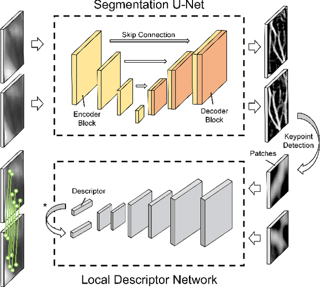 Figure 1 for FV-UPatches: Enhancing Universality in Finger Vein Recognition