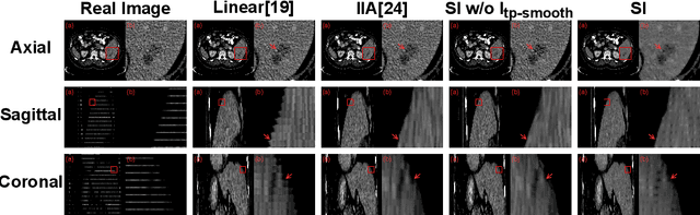 Figure 4 for Slice Imputation: Intermediate Slice Interpolation for Anisotropic 3D Medical Image Segmentation