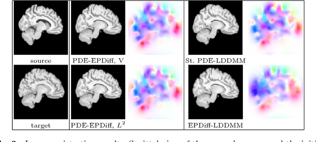 Figure 3 for PDE-constrained LDDMM via geodesic shooting and inexact Gauss-Newton-Krylov optimization using the incremental adjoint Jacobi equations