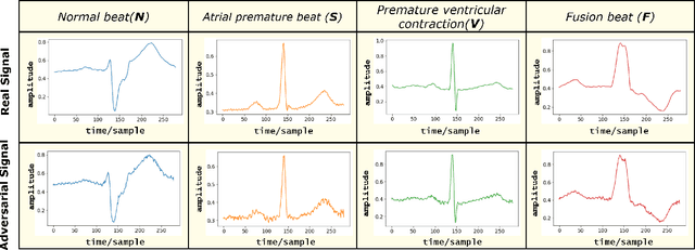 Figure 2 for ECG-Adv-GAN: Detecting ECG Adversarial Examples with Conditional Generative Adversarial Networks