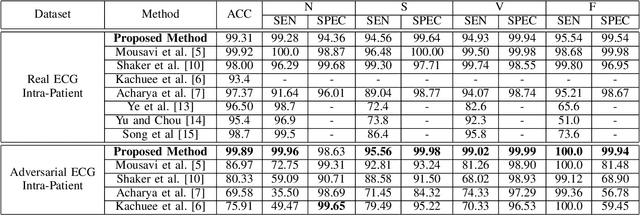 Figure 4 for ECG-Adv-GAN: Detecting ECG Adversarial Examples with Conditional Generative Adversarial Networks
