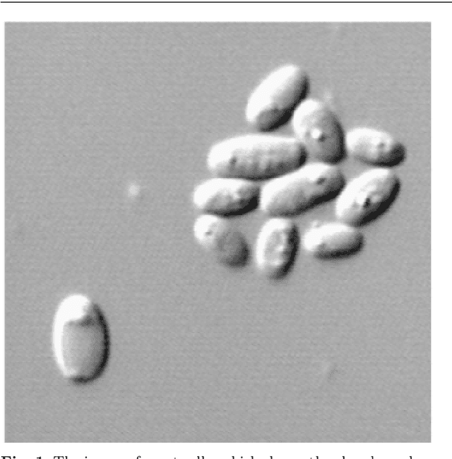 Figure 1 for A Comprehensive Survey with Quantitative Comparison of Image Analysis Methods for Microorganism Biovolume Measurements