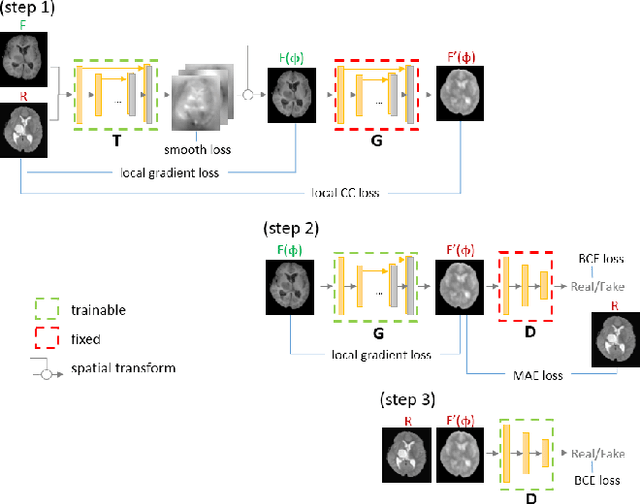 Figure 1 for Deform-GAN:An Unsupervised Learning Model for Deformable Registration