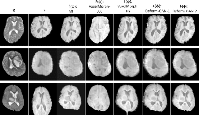 Figure 3 for Deform-GAN:An Unsupervised Learning Model for Deformable Registration