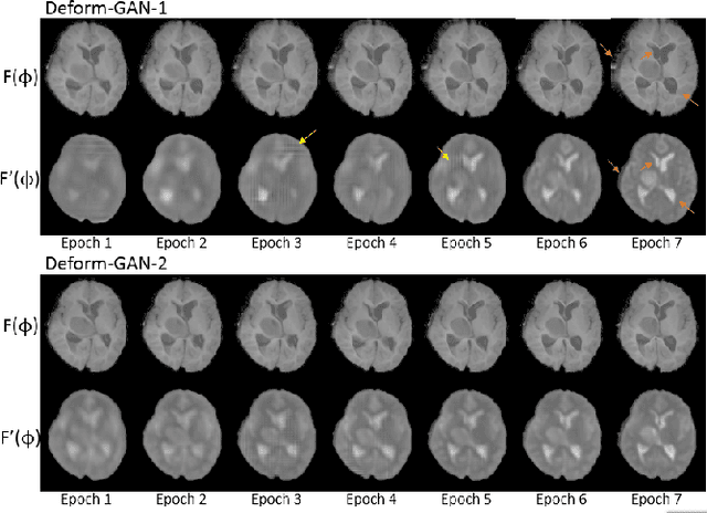 Figure 4 for Deform-GAN:An Unsupervised Learning Model for Deformable Registration