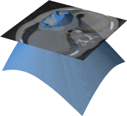 Figure 1 for Binary segmentation of medical images using implicit spline representations and deep learning