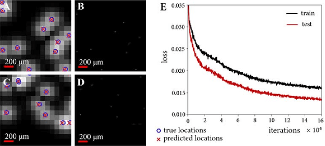 Figure 1 for Super-resolution Ultrasound Localization Microscopy through Deep Learning
