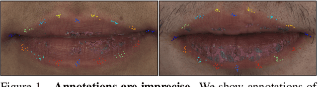 Figure 1 for Supervision-by-Registration: An Unsupervised Approach to Improve the Precision of Facial Landmark Detectors