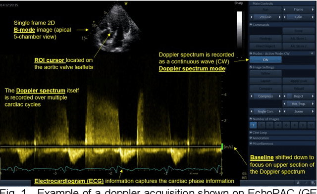 Figure 1 for Doppler Spectrum Classification with CNNs via Heatmap Location Encoding and a Multi-head Output Layer
